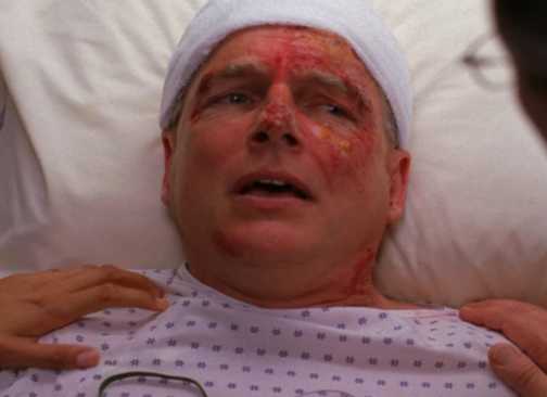 NCIS, Gibbs in a hospital bed after surviving and explosion
