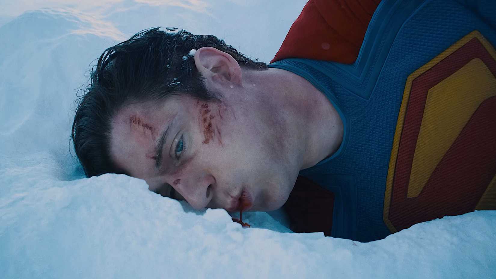 David Corenswet as a Beaten Superman