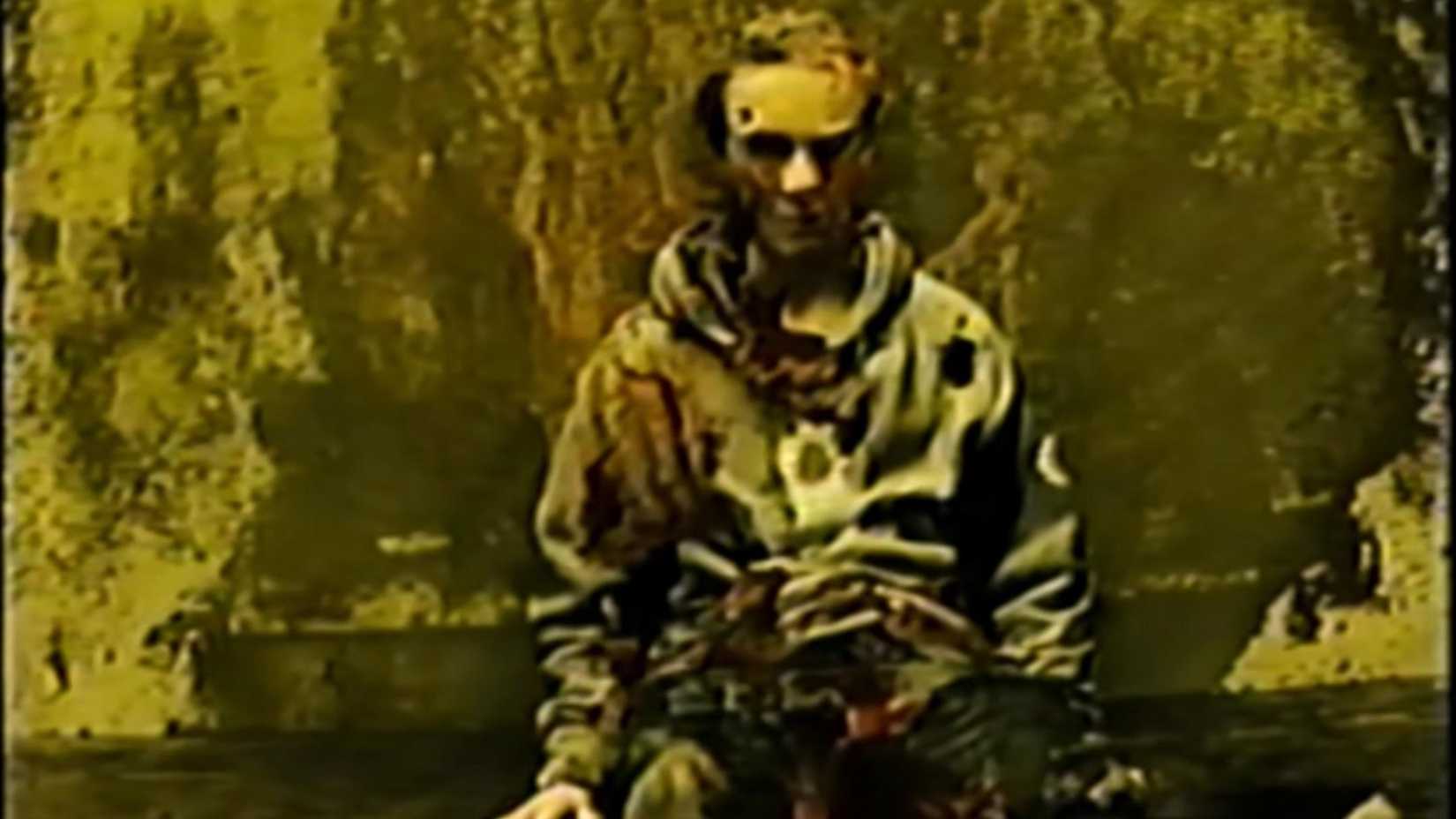 Nicolas Bolton's body covered in bacteria in the Backrooms